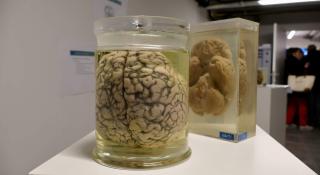 Hersenen op sterk water